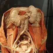 BODY WORLDS Amsterdam