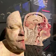 BODY WORLDS Amsterdam