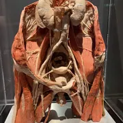 BODY WORLDS Amsterdam
