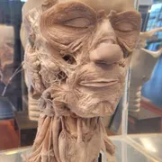 Museum voor Anatomie en Pathologie