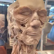 Museum voor Anatomie en Pathologie